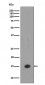 Histone H3 (mono methyl K18) Antibody