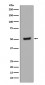 Phospho-p53 (T55) Antibody