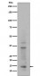 Histone H3 (mono+di+tri methyl K14) Antibody