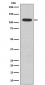 Phospho-Retinoblastoma (S807) Antibody 