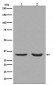 active + pro Caspase 3  Antibody 