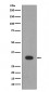 Lin28B Antibody