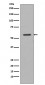 Tyrosine Hydroxylase Antibody 