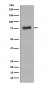 Phospho-BTK (Y223) Antibody 