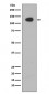 ATP citrate lyase Antibody 