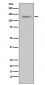 Progesterone Receptor Antibody