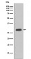 Troponin I Antibody