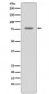 GRK2 Antibody