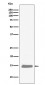 Hemoglobin subunit alpha Antibody