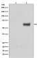 Phospho-ER alpha (S118) Antibody