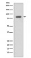 IKK beta Antibody