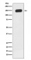 PLC gamma 1 Antibody