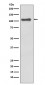 NALP3 Antibody