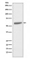 Cytokeratin 5 Antibody