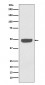 NSE Antibody