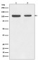 Retinoblastoma Antibody