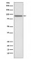 Phospho-STAT1 (S727) Antibody