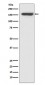 CD21 Antibody