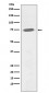 Phospho-BTK (Y551) Antibody