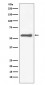 Tyrosine Hydroxylase Antibody