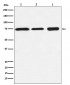 BTK Antibody