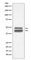 Cytokeratin 18 Antibody