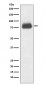 CD36 Antibody