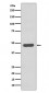 Tissue Factor Antibody