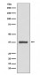 CDK6 Antibody