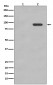 Phospho-beta Catenin (S33/S37) Antibody