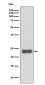 MGMT Antibody