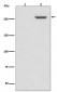 Phospho-mTOR (S2481) Antibody