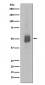 Phospho-Lyn (Y396) Antibody