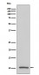 IGF2 Antibody