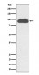 Transferrin Receptor (CD71) Antibody