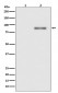 Phospho-PKC alpha (T638) Antibody