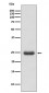 Thymidine Kinase 1 Antibody