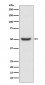 PDIA6 Antibody