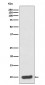 S100 alpha 6 Antibody