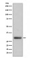 Neutrophil Elastase Antibody