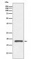 Prealbumin Antibody