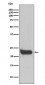 Interferon beta Antibody