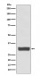 Galectin 3 Antibody