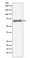 AFP Antibody