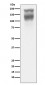 CEA(CD66e) Antibody