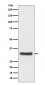 NQO1 Antibody