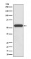 Aromatase Antibody