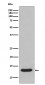 FABP1 Antibody