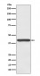 Haptoglobin Antibody