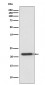 TIMP2 Antibody